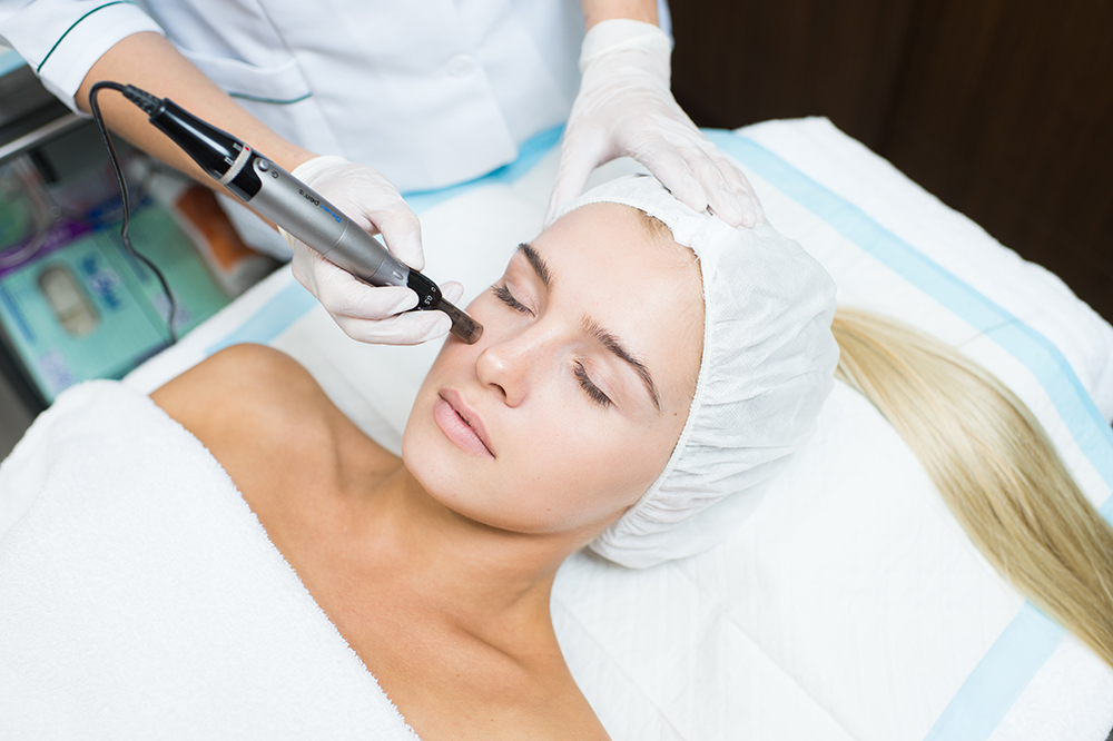 microneedling-bbglow